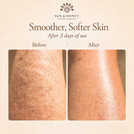 Image showing skin before and after Sun and Honey Tallow Balm use